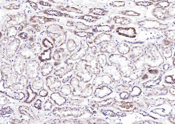 MUC13 Rabbit Polyclonal Antibody