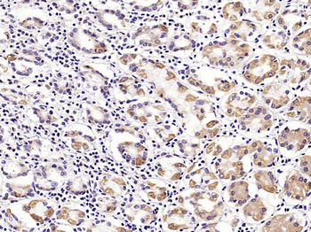 MUC5AC Rabbit Polyclonal Antibody