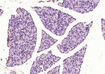 Musashi 1 Rabbit Polyclonal Antibody