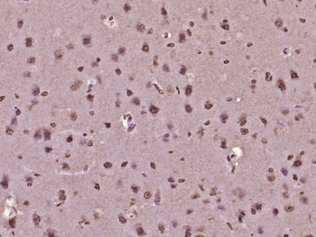 MYO6 Rabbit Polyclonal Antibody
