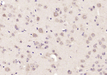 NELL2 Rabbit Polyclonal Antibody