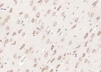 NELL2 Rabbit Polyclonal Antibody