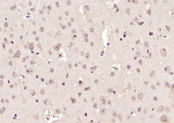 NEURL Rabbit Polyclonal Antibody