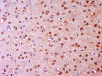 NGFR/p75NTR Rabbit Polyclonal Antibody
