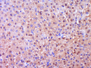 NGFR/p75NTR Rabbit Polyclonal Antibody