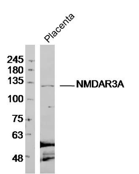 NMDAR3A Rabbit Polyclonal Antibody