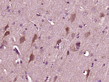 NMS Rabbit Polyclonal Antibody