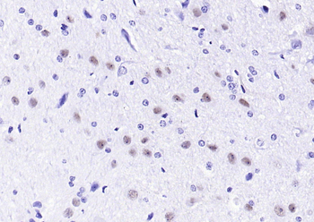 Nova1 Rabbit Polyclonal Antibody