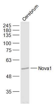 Nova1 Rabbit Polyclonal Antibody