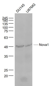 Nova1 Rabbit Polyclonal Antibody
