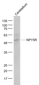 NPY5R Rabbit Polyclonal Antibody
