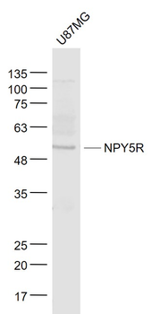 NPY5R Rabbit Polyclonal Antibody