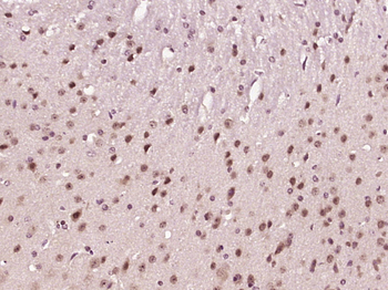 NR5A2 Rabbit Polyclonal Antibody