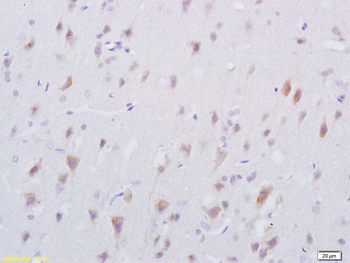 Oligophrenin 1 Rabbit Polyclonal Antibody