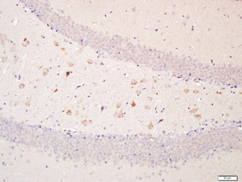 Optineurin Rabbit Polyclonal Antibody