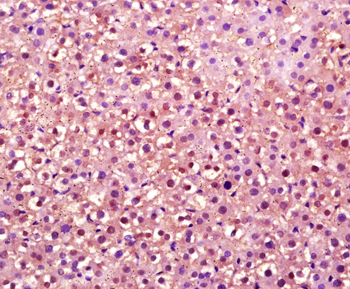 OVOL2 Rabbit Polyclonal Antibody
