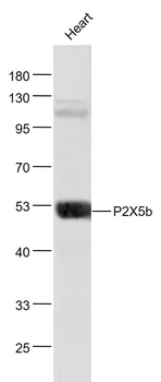 P2X5b Rabbit Polyclonal Antibody