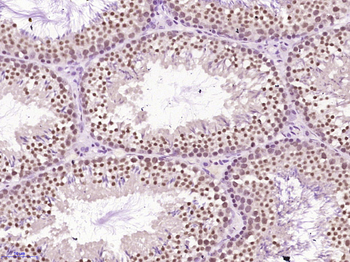 PAPOG Rabbit Polyclonal Antibody