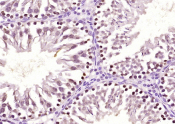 PAPOLB Rabbit Polyclonal Antibody