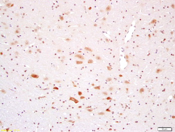 PAPOLB Rabbit Polyclonal Antibody