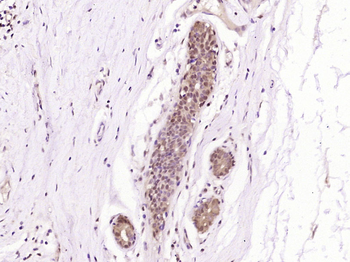 PCYT1A Rabbit Polyclonal Antibody