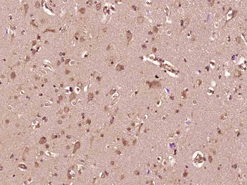 PDGF-A Rabbit Polyclonal Antibody