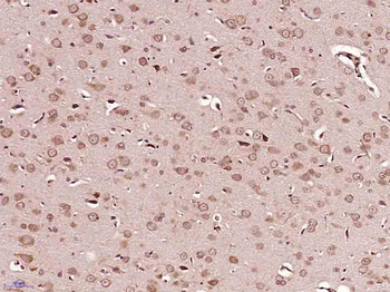 PDGF-A Rabbit Polyclonal Antibody