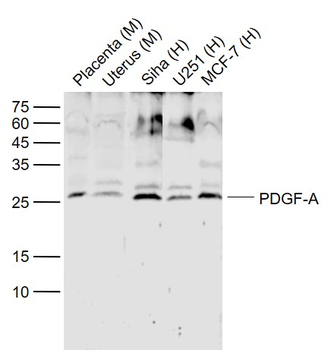 PDGF-A Rabbit Polyclonal Antibody