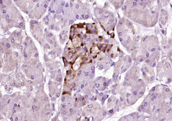 PDSS2 Rabbit Polyclonal Antibody