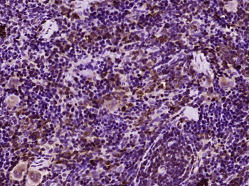 Perforin Rabbit Polyclonal Antibody