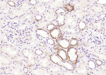 ART1 Rabbit Polyclonal Antibody