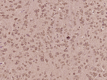 PISD Rabbit Polyclonal Antibody