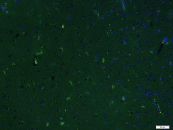 MCT1 Rabbit Polyclonal Antibody (BF488)