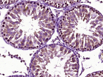 Phospho-PKC Epsilon (Ser729) Rabbit Polyclonal Antibody