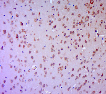 Phospho-PKC Epsilon (Ser729) Rabbit Polyclonal Antibody
