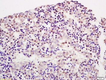 Placental lactogen I+II Rabbit Polyclonal Antibody