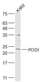 POD1 Rabbit Polyclonal Antibody