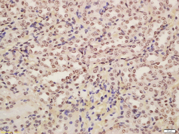 POD1 Rabbit Polyclonal Antibody