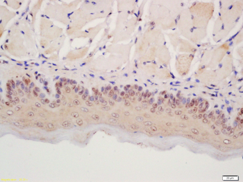 POD1 Rabbit Polyclonal Antibody