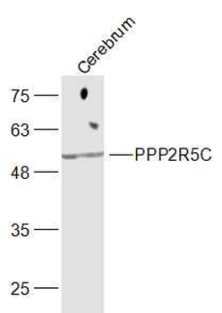 PPP2R5C Rabbit Polyclonal Antibody