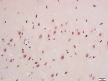 PPP2R5C Rabbit Polyclonal Antibody