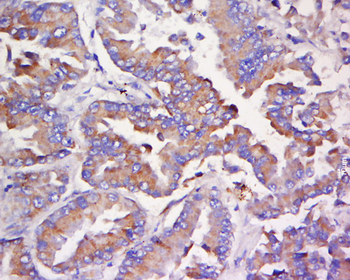 PR3 Rabbit Polyclonal Antibody