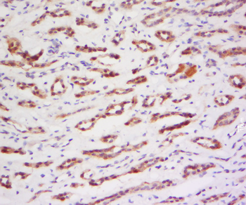 PRAM1 Rabbit Polyclonal Antibody