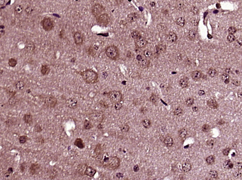 Presenilin 1 + 2 Rabbit Polyclonal Antibody