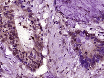 PTBP1 Rabbit Polyclonal Antibody