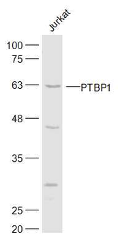 PTBP1 Rabbit Polyclonal Antibody