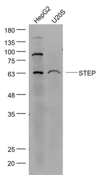 STEP Rabbit Polyclonal Antibody