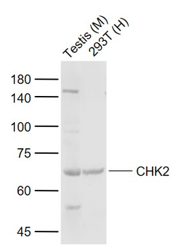 CHEK2 Rabbit Polyclonal Antibody