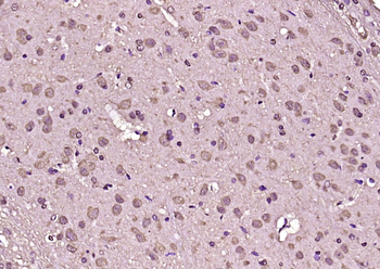 RASA1 Rabbit Polyclonal Antibody