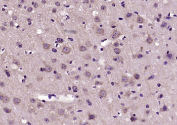 RTN1 Rabbit Polyclonal Antibody